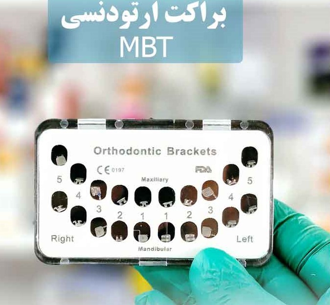 براکت MBT با طراحی حرفه‌ای برای درمان ارتودنسی